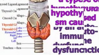 hypothyroidism in children - hypothyroidism treatment - hypothyroidism remedies
