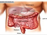 Leaky Gut Syndrome Symptoms