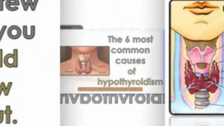 hypothyroidism natural remedies - treatment for hypothyroidism - treatment of hypothyroidism