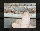 Help For Your Bed Bug Infestation- Remove Bed Bugs