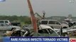 Rare Fungus Threatens Joplin Tornado Victims