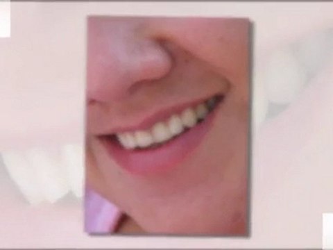 Chipped Tooth Orlando - 407-774-4171 - Emergency Dental Care Orlando Florida