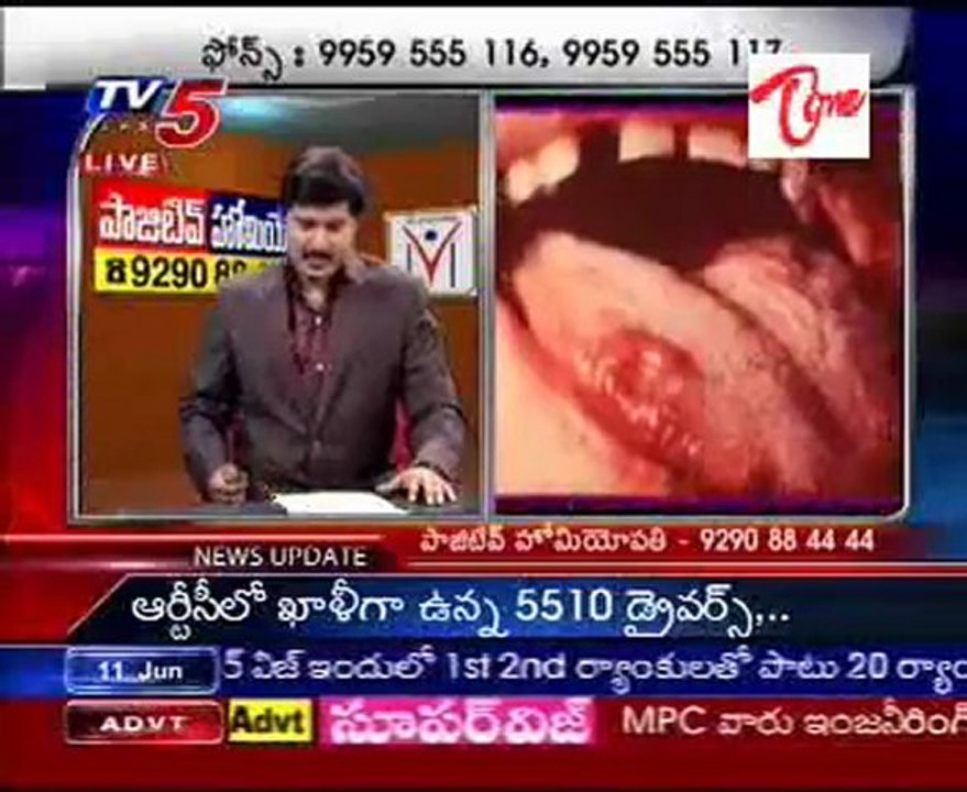Health File - Sexually Transmitted Diseases(STD) problems  - Dr. Chandrashekar - 01