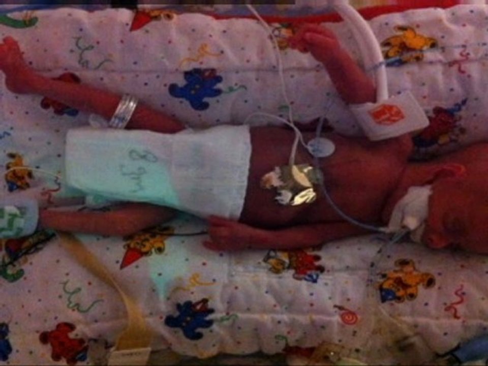 Miracle baby