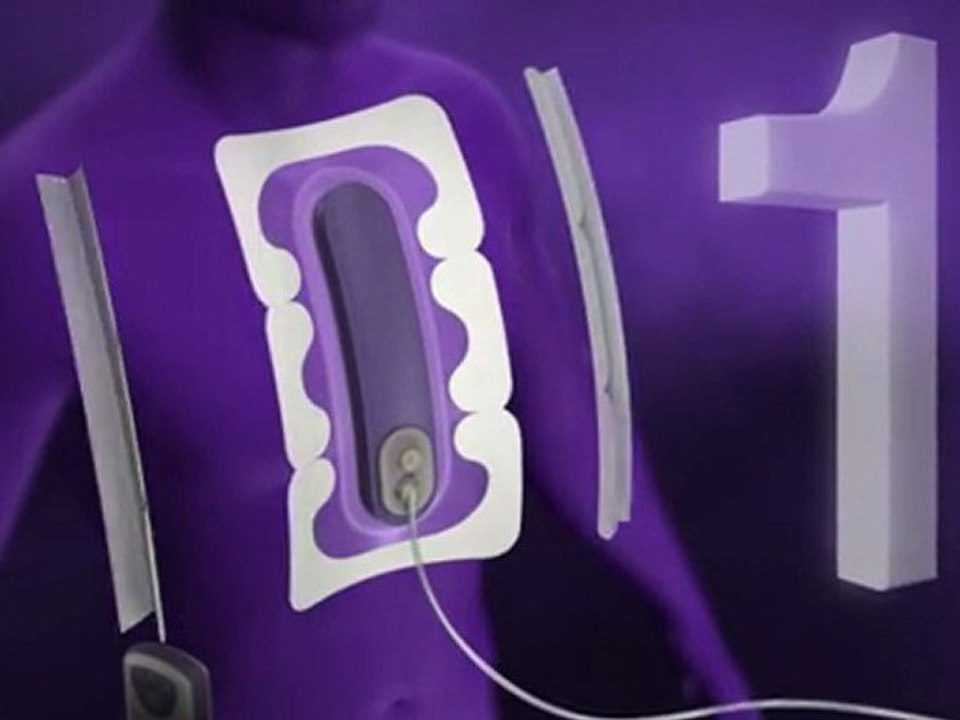 Incision Management System | Prevena | KCI