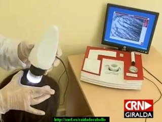 rebertir la caida de el cabello de manera natural