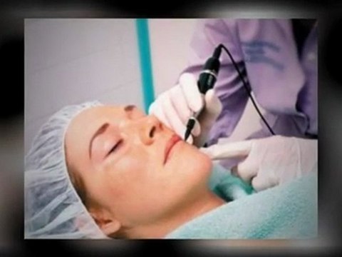 Find the effective acne laser skin treatment NYC