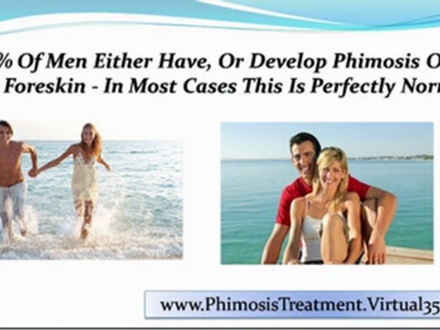 phimosis treatment emedicine – phimosis treatment options