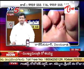 Health File - Skin Disease and Conditions - Part 01