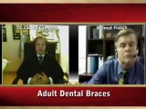 Dental Sealants by Pediatric Dentist, Tinley Park, IL Dr. Zack Zaibak