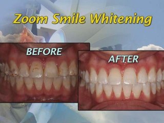 Tamborello Dental - Magnolia, TX - Cosmetic, Preventive, TMJ Treatment, and Implant Therapy