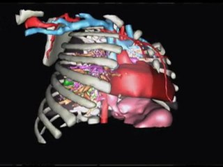 Patient Virtuel Clip 3