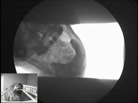 Car Accident | Vancouver Wa | Portland Or | Chiropractor | Personal Injury | DMX | MRI