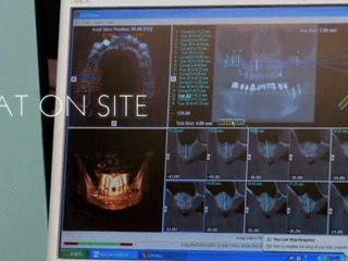 Dental Implants in Sun City - Know What The Patients Say