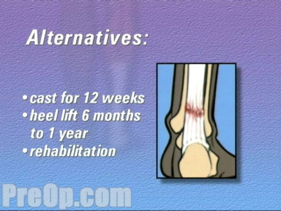 Achilles Tendon Repair Surgery  - Alternatives
