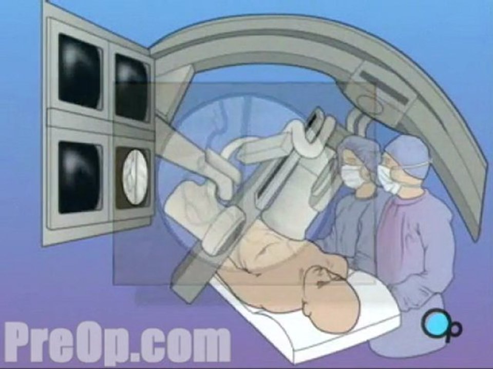 Cardiac Catheterization Angiography  - Alternatives