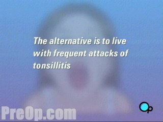 Tonsillectomy  - Alternatives