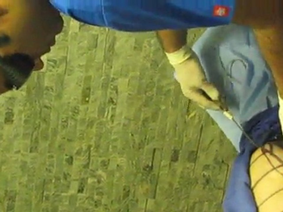 Laser Liposuction-Los Angeles County-Orange County-Riverside County-San Bernardino County-Inland Empire-Anaheim-Fullerton-Rancho Cucamonga-Irvine-Orange-Cerritos-Whittier-Covina-Hacienda Heights-Rowland Heights