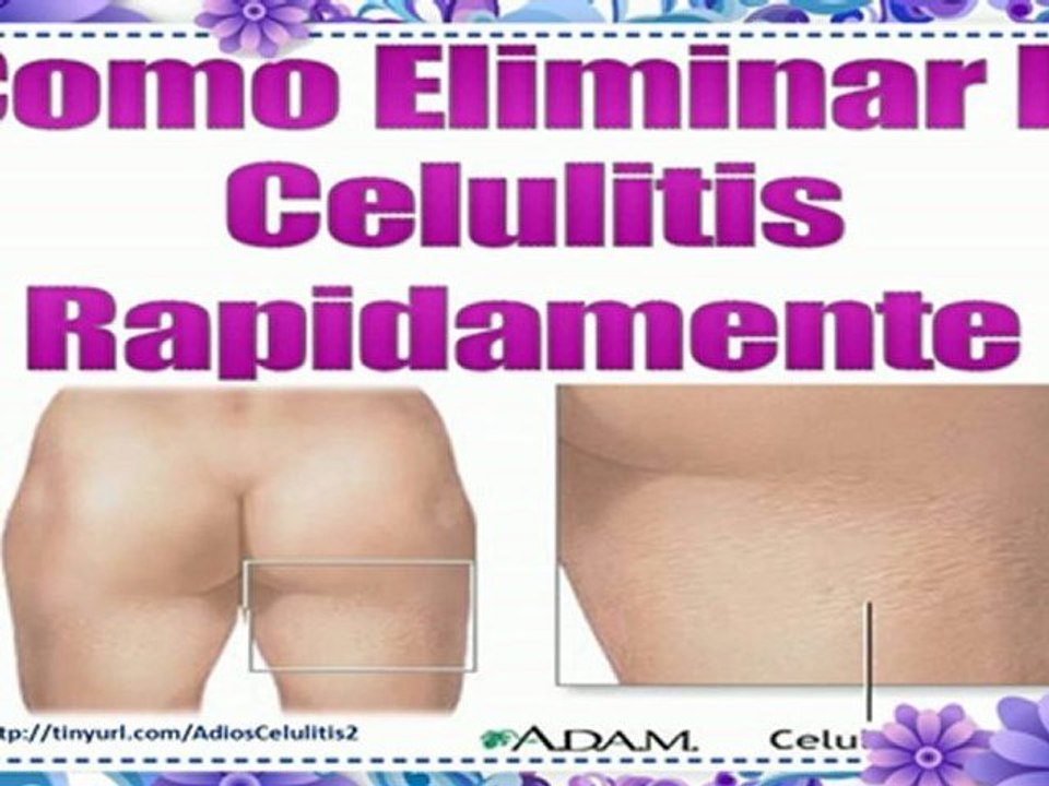 Como Eliminar la Celulitis Rapidamente-Como Disminuir la Celulitis