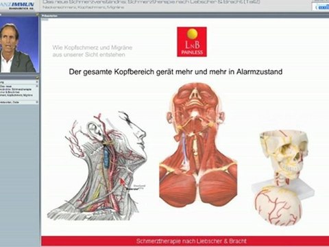 Die LNB Schmerztherapie bei Migräne - Teil 1
