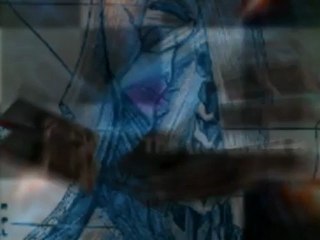 Treatment of Multiple Sclerosis