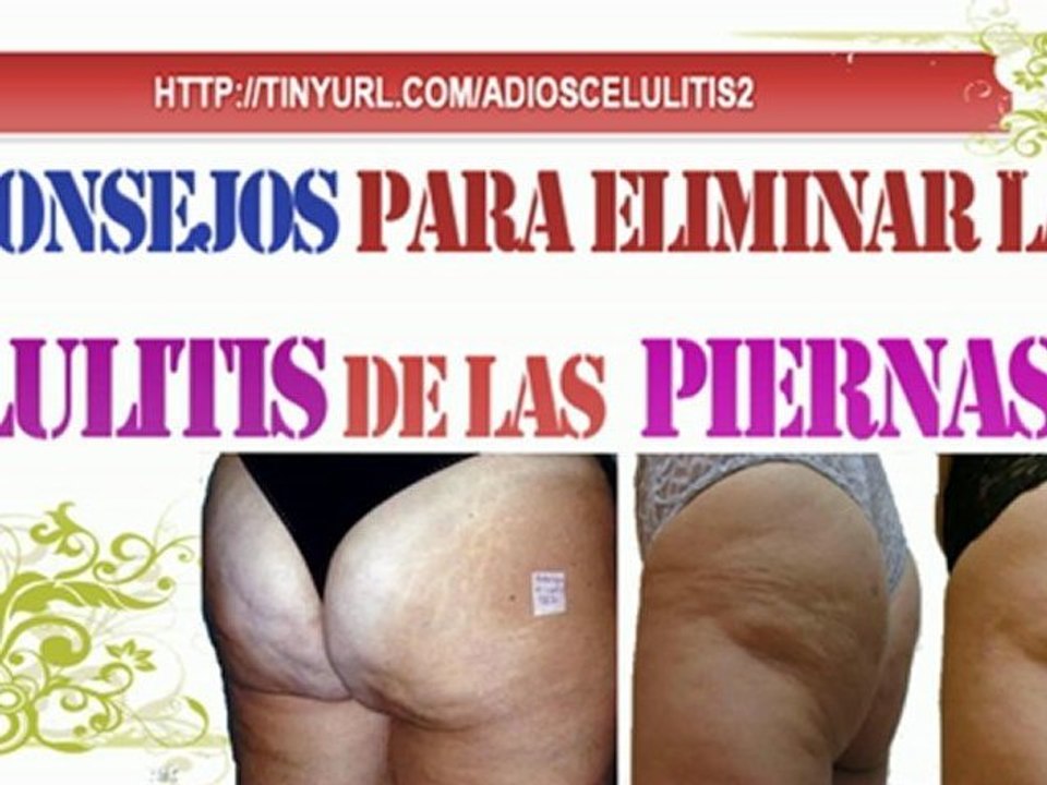 8 Consejos para Eliminar la Celulitis de las Piernas-Como Eliminar la Celulitis