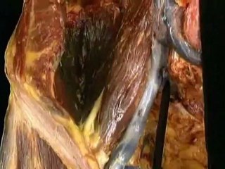 Lower LIMB--part1(b)-cut