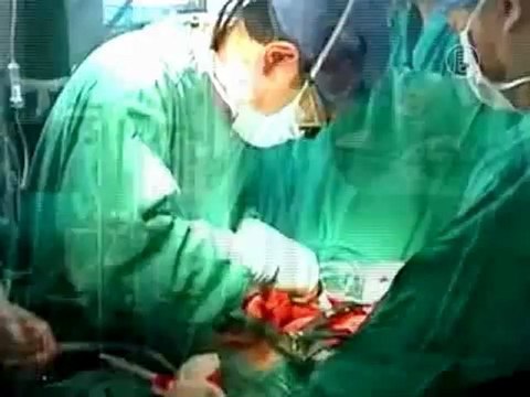 В Конгрессе США говорили об изъятии органов в КНР