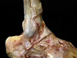 lower limb--Part 3(a)