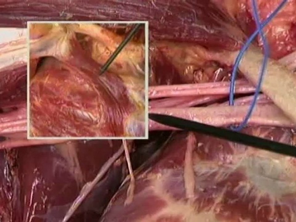 Upper limb--Part 1(b)
