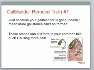 The Shocking Truth About Gallbladder Removal