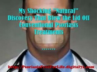 How To Get Rid Of Psoriasis Scales - Psoriasis Scalp Treatment
