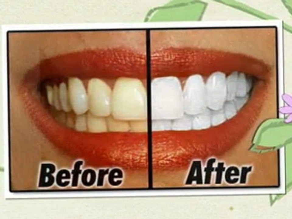Creating a Good-looking Smile with Broomall Emergency Dentist