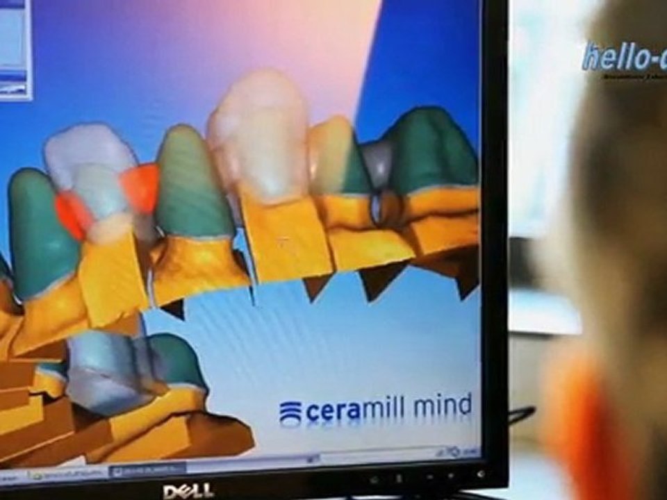 Hello-dent: bezahlbarer zahnersatz für alle