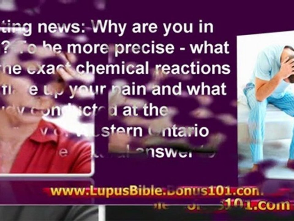 cutaneous lupus - lupus bible - lupus books