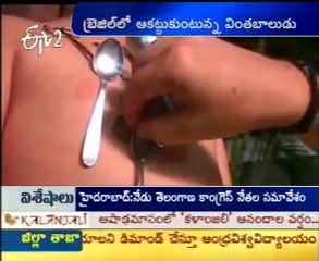 Magnetic Boy Attracts People In Brazil