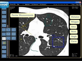 PACS - Picture Archiving Communication System Software