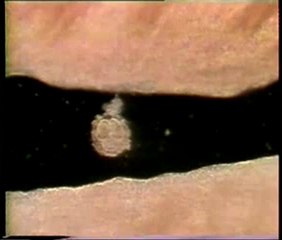 İnsanın "alak"tan yaratılışı