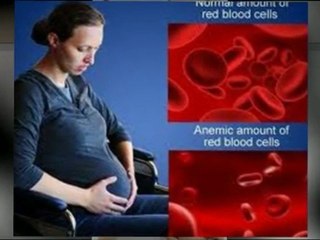 The bloody reality regarding Hemoglobin levels