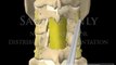 Cervical Spine Surgery Decompression Laminectomy + Lateral Mass Screw Fusion Fixation neurosurgical videos