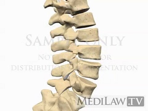 Lumbar Spine Anatomy Vertebra Vertetebral Body Pars Inter-articularis neurosurgeon animations