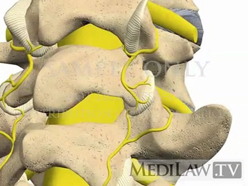 Lumbar Spine Pathology Zygoapophysial Facet Joint Syndrome chiropractry 3D animations