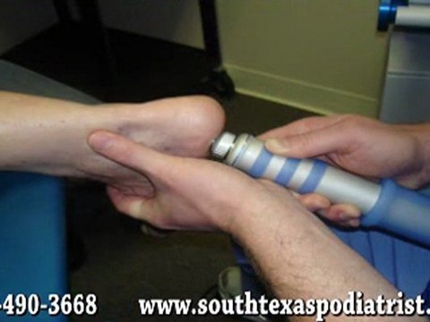 Plantar Fasciitis Treatment - Podiatrist in San Antonio, Liv