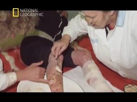 NG | Bilimin Ta Kendisi: Kirli Bomba