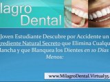 milagro dental remedios caseros para blanquear los dientes