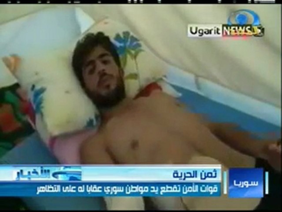 قوات الأمن السوري تقطع يد مواطن سوري
