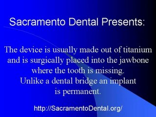 Sacramento Dental What is a Dental Implant