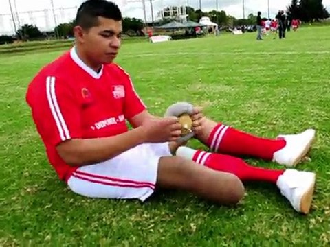 Colombie: match entre victimes de mines et ex-stars du football