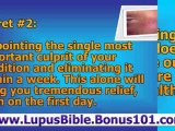 lupus of the scalp - lupus of the skin - lupus rash