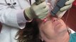 Facial Skin Resurfacing and Skin Tightening With Fotona Erbium Laser-Valey Aesthetics and Laser-626-961-7700